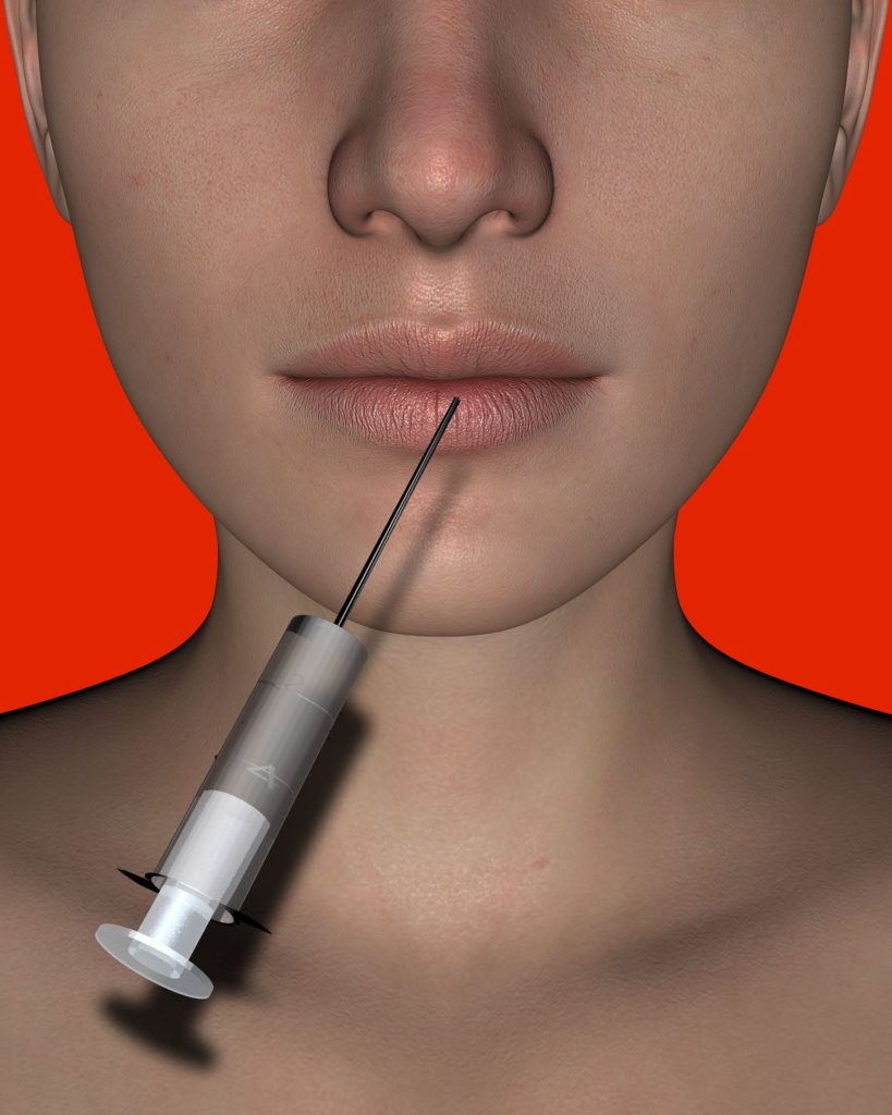 Botox needle injected into women's lips