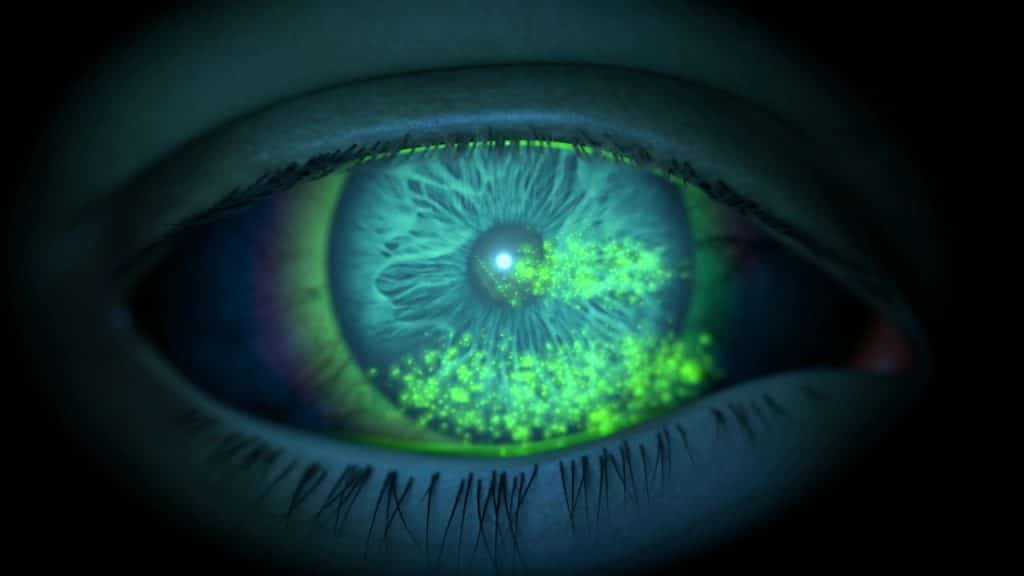 New treatment for severe corneal inflammation from dry eye disease now ...