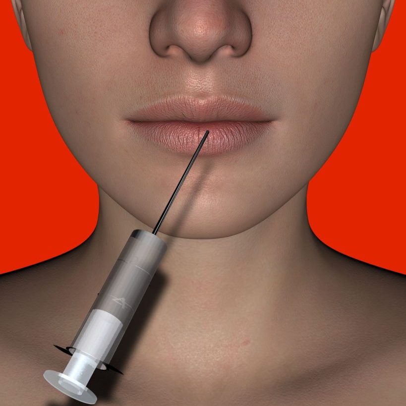 Botox needle injected into women's lips